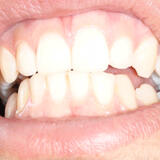 miso-f_DSC00599.JPG